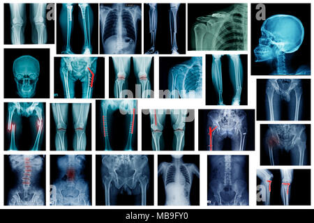 High quality collection x-ray image show many body part of human