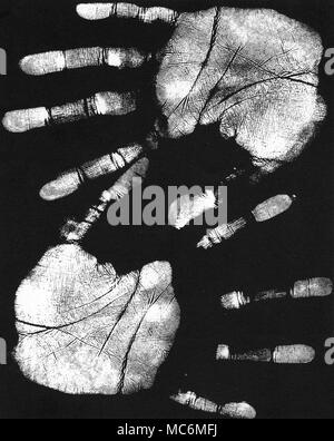 PALMISTRY - SAMPLE HAND-PRINTS The left and right impressions of the hands of same subject were made by rolling the two hands with black ink, and printing these on to white paper. To help interpretation, the prints were then reversed, black to white, photographically. Stock Photo