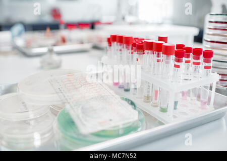 Test tubes with Petri dishes on the table in bacteriological department of laboratory Stock Photo