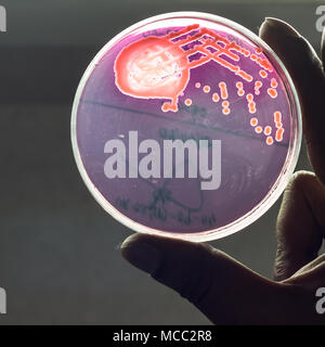 Bacterial culture plate showing growth of bacterial colony in mac conkey blood agar held by hand Stock Photo