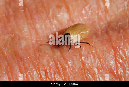 A Castor bean tick on the wrinkly skin of a hand Stock Photo