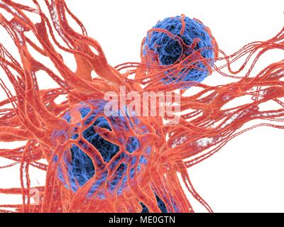 Cancer cell. Computer illustration of cancer cells, showing the blood vessel formation providing the the cells with oxygens and nutrigens. The cells with their nuclei are shown in blue. Stock Photo