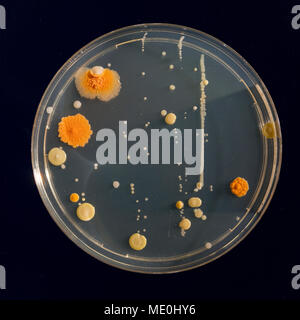 Cultures growing on Petri dish. Stock Photo