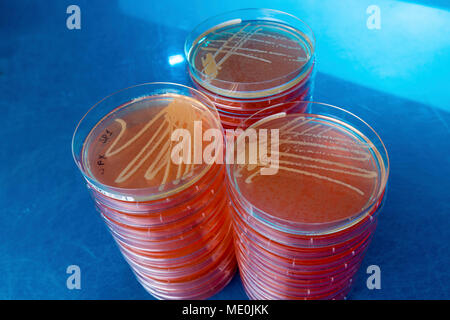 Cultures growing on Petri dish. Stock Photo