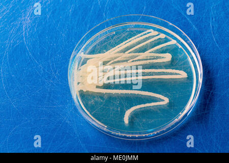 Cultures growing on Petri dish. Stock Photo