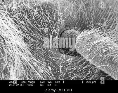 Morphologic details of the unidentified insects head, ball-and-socket type joint, depicted in the 100x magnified scanning electron microscopic (SEM) image, 2005. Image courtesy Centers for Disease Control (CDC) / Janice Haney Carr. () Stock Photo
