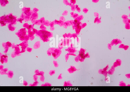 Multiple squamous epithelium under the microscope - Abstract pink dots on white background. Stock Photo