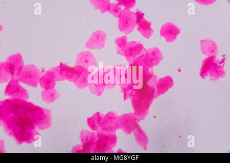 Multiple squamous epithelium under the microscope - Abstract pink dots on white background. Stock Photo