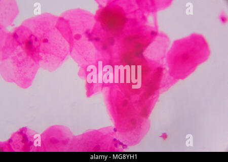 Multiple squamous epithelium under the microscope - Abstract pink dots on white background. Stock Photo