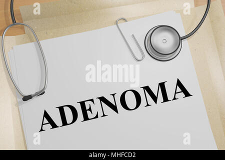 3D illustration of ADENOMA title on a medical document Stock Photo