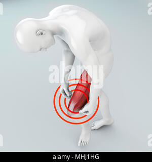 Muscle tearing, thigh muscles above the knee. Pain in the leg and ligaments. Human body, 3d rendering Stock Photo