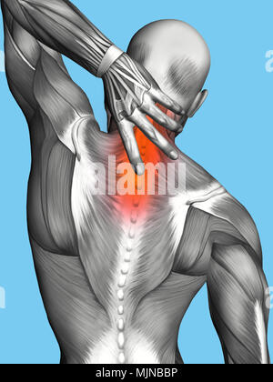 Anatomy of Male With Upper Back Pain Stock Photo