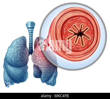 COPD chronic obstructive pulmonary disease as a medical concept for lung illness and emphysema with 3D illustration elements. Stock Photo