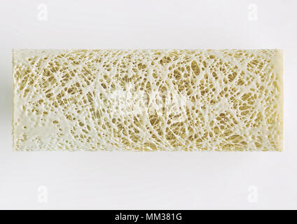 Cross section of an advanced osteoporosis -high details - Stage 4 - 3d ...