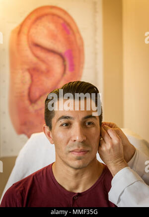 Battlefield Acupuncture is a standardized auricular acupuncture method ...