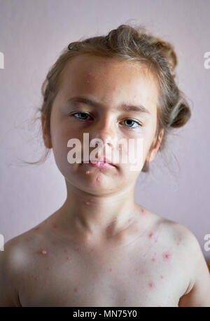 6 year old girl naked