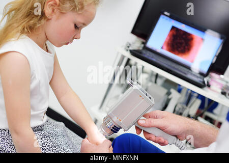 the doctor examines the special medical device moles child Stock Photo