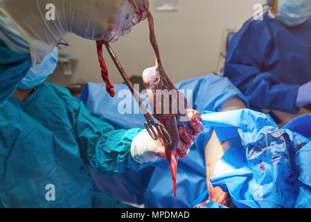 Doctor hold woman placenta on hospital background close up Stock Photo