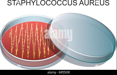 illustration of a culture of Staphylococcus aureus in a Petri dish Stock Vector