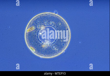 Arcella sp.Amoeba.Rhizopoda.Protozoans.Optic microscopy Stock Photo