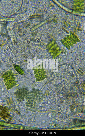 Light photomicrograph of Blue green algae / Cyanobacteria (Nostoc sp ...