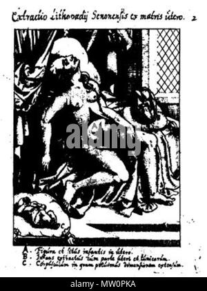 . Steinkind von Sens . 16th century. unbekannt, verwendet von Jean d'Ailleboust in seiner Beschreibung des Steinkindes von Sens, 1582 575 Steinkind von Sens Kopenhagen Stock Photo