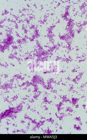 Salmonella typhi Bactery of typhoid fever Gram Stock Photo - Alamy