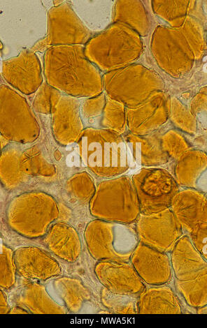 Adipose tissue, light micrograph Stock Photo - Alamy