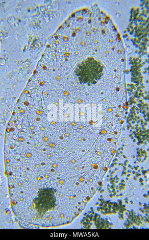 Amoeba.Pelomyxa sp.Rhizopoda.Protozoans.Optic microscopy Stock Photo