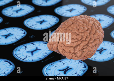 3d rendering human brain X ray Stock Photo - Alamy