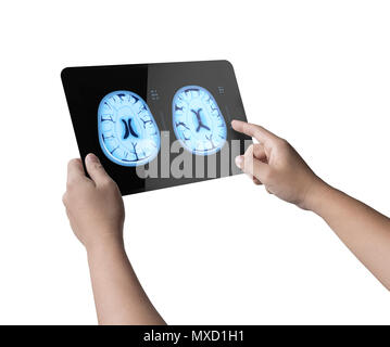 Hand holding 3d rendering digital tablet display x-ray brain isolated on white Stock Photo