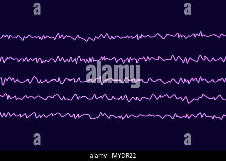 Brain waves in awake state with mental activity, computer illustration. An electroencephalogram (EEG) measures electrical activity in the brain using electrodes attached to the scalp. Various disorders can be diagnosed by analysing EEG results. Stock Photo