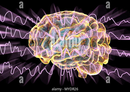 Brain and brain waves during sleeping, computer illustration. An electroencephalogram (EEG) measures electrical activity in the brain using electrodes attached to the scalp. Various disorders can be diagnosed by analysing EEG results. Stock Photo