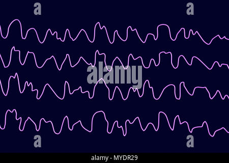 Brain waves during sleeping, computer illustration. An electroencephalogram (EEG) measures electrical activity in the brain using electrodes attached to the scalp. Various disorders can be diagnosed by analysing EEG results. Stock Photo