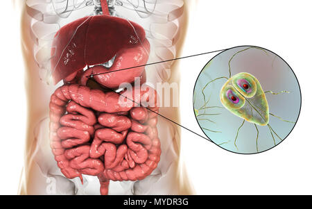 Giardia lamblia in the human duodenum, computer illustration. Giardia lamblia is single-celled protozoan that has flagellae for motility. It causes the disease giardiasis (or lambliasis), an infection of the small intestine most common in tropical areas. Giardia lamblia attaches by means of sucking discs to microvilli in the human intestine. Abdominal cramps, bloating, diarrhoea and nausea may occur. The organism is spread by direct contact or through contaminated food and water. Stock Photo