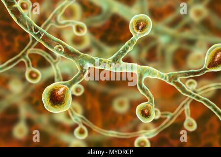 Blastomyces dermatitidis fungus, computer illustration. This fungus is the causative agent of the disease blastomycosis, which has a range of presentations. It mainly affects the lungs and may cause a flu-like disease, an acute disease similar to pneumonia, a chronic illness similar to tuberculosis or the potentially fatal acute respiratory distress syndrome. In some cases it can spread to the skin, bones or organs, causing lesions. Treatment is with antifungal drugs. Stock Photo