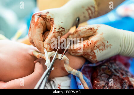 Father cuts the umbilical cord between a newborn baby and placenta Stock Photo