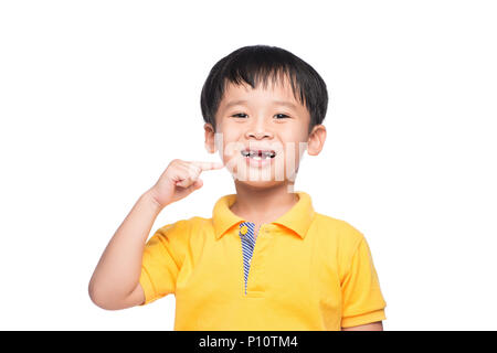 Lost milk tooth asian boy, Close up view. Stock Photo