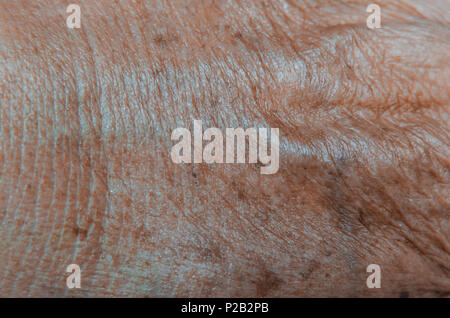 Close-up of brown spots on the skin, Skin spots on the hand caused by radiation from the sun, Macro of the wrinkle and scar. Stock Photo