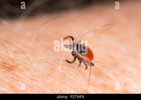 A female tick, Ixodes ricinus, crawling on a human arm. It was found in an area where deer and other mammals are present. This tick is also known as a Stock Photo