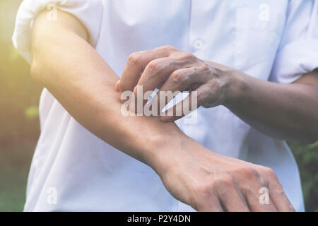 Man scratch itch with hand. Man scratching his arm healthcare concept.