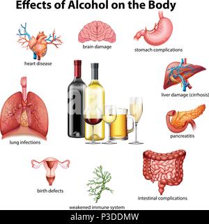 Effects Of Alcohol On The Body Stock Vector Image Art Alamy Effects Of Alcohol On The Body Stock Vector Image Art Alamy