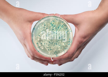 Female hands holding a Petri dish with bacterial colonies on agar-agar. Blue-white selection of E.Coli to detect insertions of vector construct into a Stock Photo