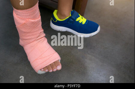 Children wearing a splint of leg broken from injury. Stock Photo