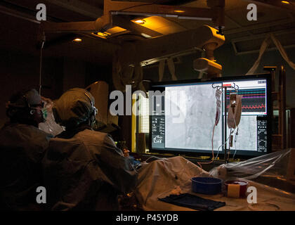 An x-ray displays a coronary stent system being deployed via balloon in the Right Coronary Artery of a patient during an ST- Segment Elevation Myocardial infarction, or STEMI, procedure at the catheterization laboratory, William Beaumont Army Medical Center, June 29. WBAMC currently holds the fastest door-to-balloon times in the Department of Defense and the City of El Paso, Texas, averaging 50 minutes over the last two years. Door-to-balloon time is the measurement of time necessary from the point of patient arrival to the point a catheter with a small balloon is deployed placing a coronary s Stock Photo