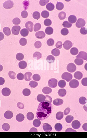 Blood. Light micrograph of red blood cells (erythrocytes, red) in a