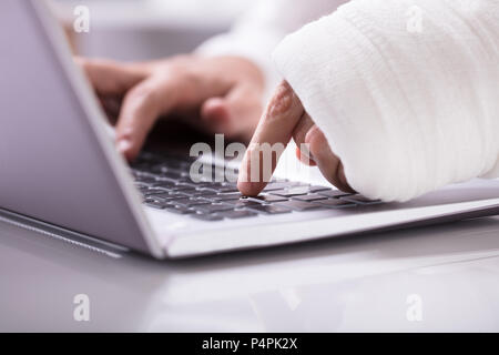 Close-up Of A Man With Wrapped Bandage On His Hand Using Laptop At Workplace Stock Photo