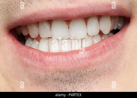 Close-up of mans smile with clean white teeth Stock Photo