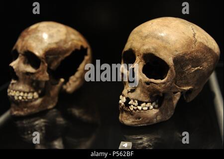 Skull of a young girl. 16 years old. 3500-3400 BC. Sigersdal Mose, Northern Zealand. National Museum of Denmark. Copenhagen. Denmark. Stock Photo