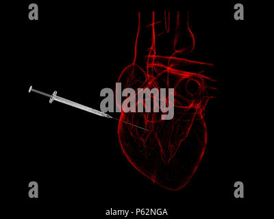 X-ray red injection of human heart 3d illustration on black background Stock Photo